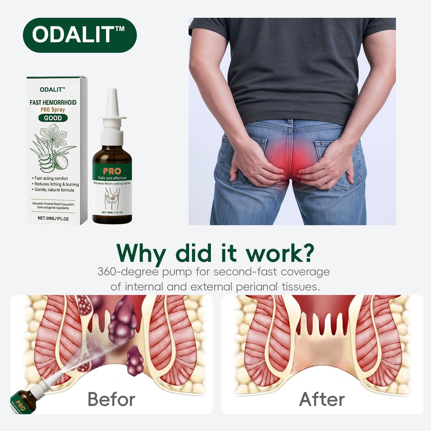 ODALIT™ Fast Hemorrhoid PRO Spray