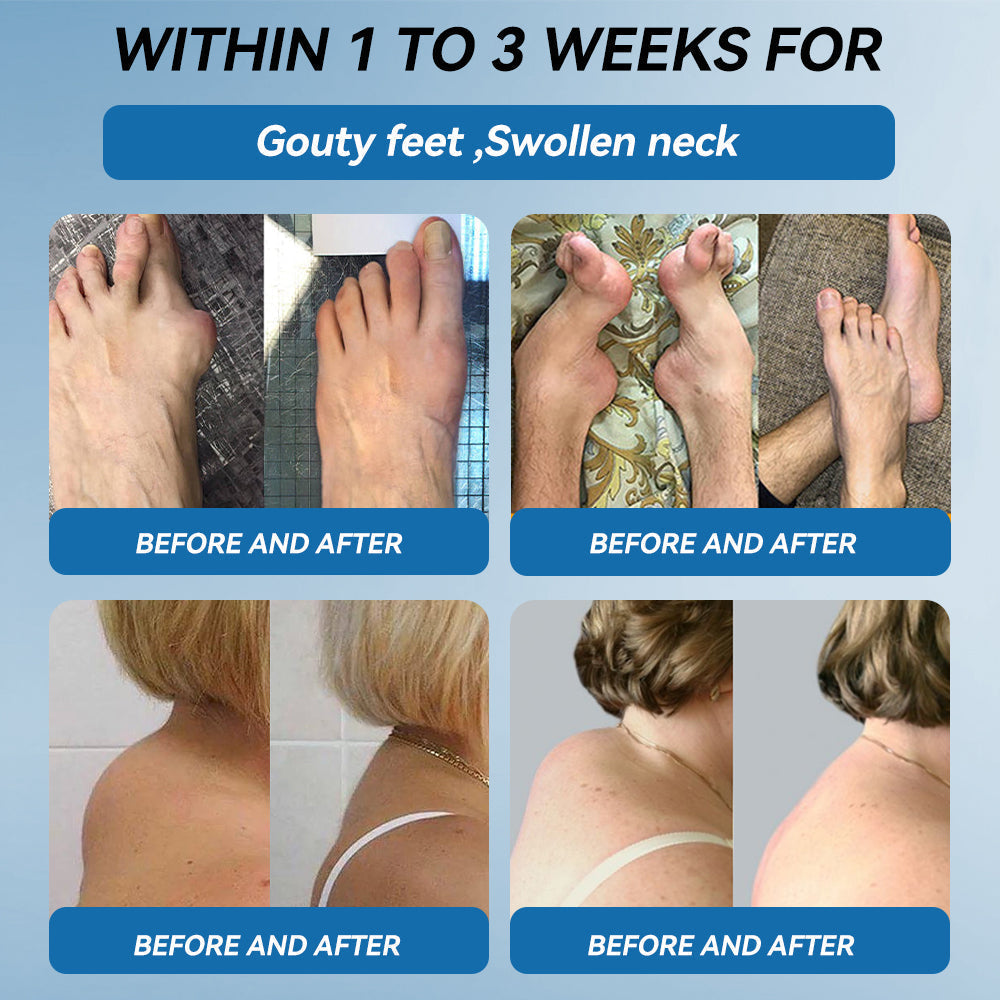 🇬🇧𝐟𝐥𝐲𝐬𝐦𝐮𝐬® 𝐁𝐏𝐂-𝟏𝟓𝟕 𝐉𝐨𝐢𝐧𝐭 𝐇𝐞𝐚𝐥𝐢𝐧𝐠 𝐂𝐫𝐞𝐚𝐦🦴Treats Arthritis, Neuropathy, Rheumatism, Sports Injuries & More🇬🇧🏆